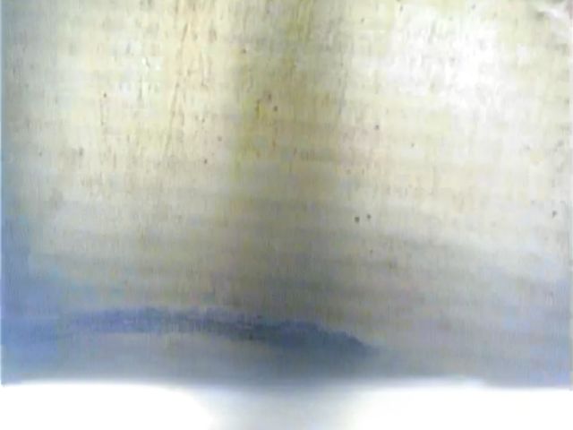 Tubage plein dégagé en bon état après Hydropuls® - Forapulse